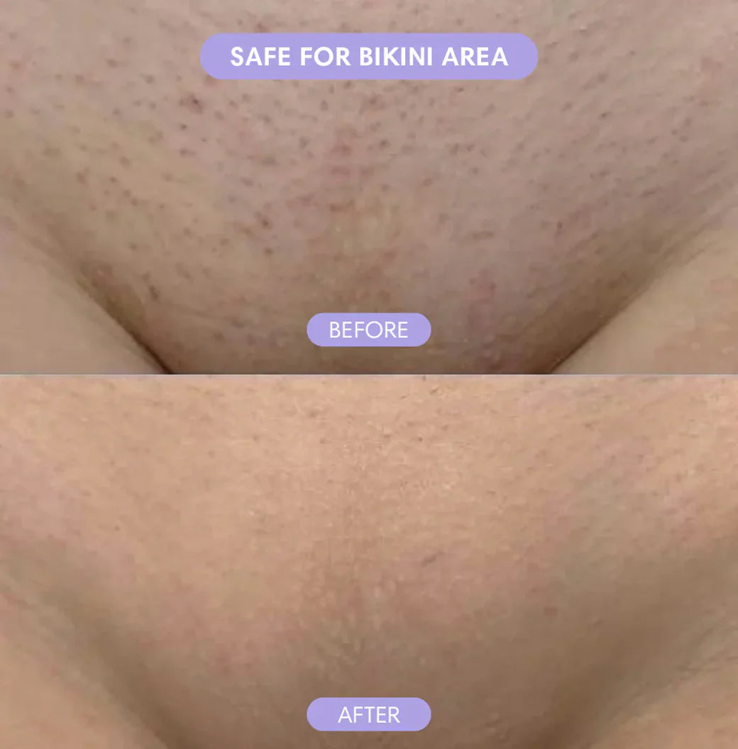 Alvessa Hair Removal Cream