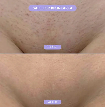 Alvessa Hair Removal Cream