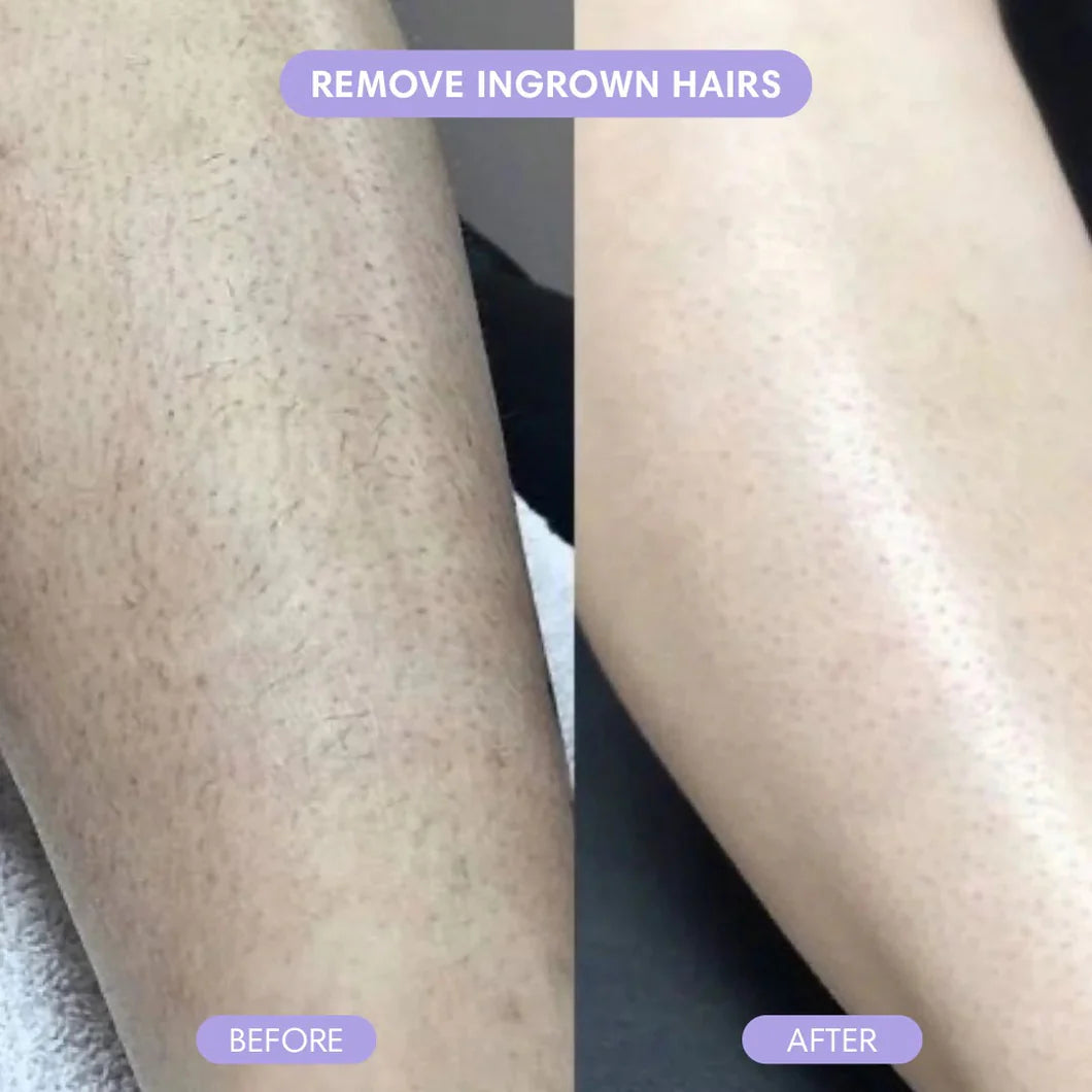 Alvessa Hair Removal Cream