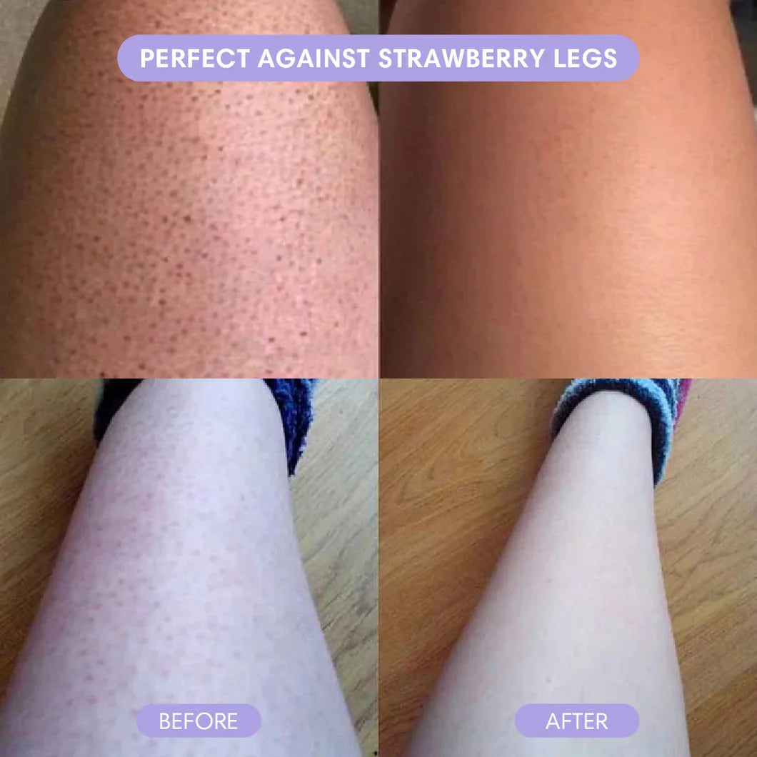 Alvessa Hair Removal Cream